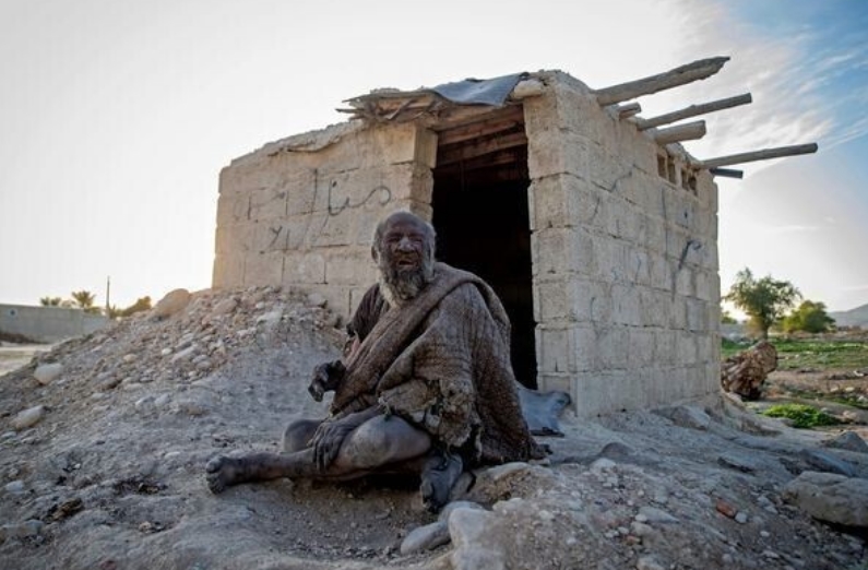 奇葩吉尼斯世界纪录有哪些__奇葩吉尼斯世界纪录身体部分